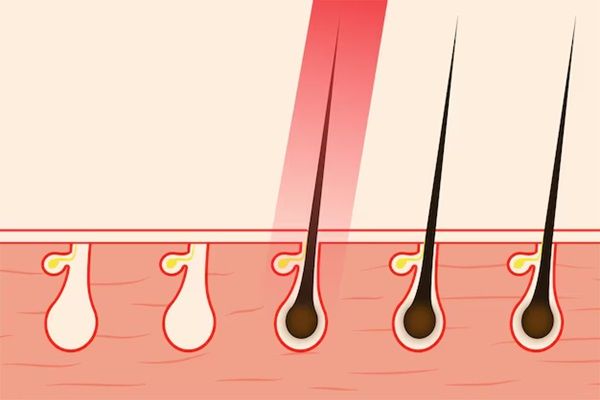 immagine illustrativa sulla crescita dei capelli