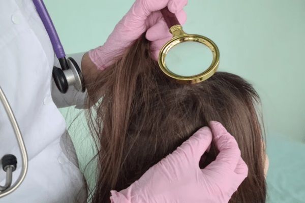 paziente con professionista di capelli per diagnosi