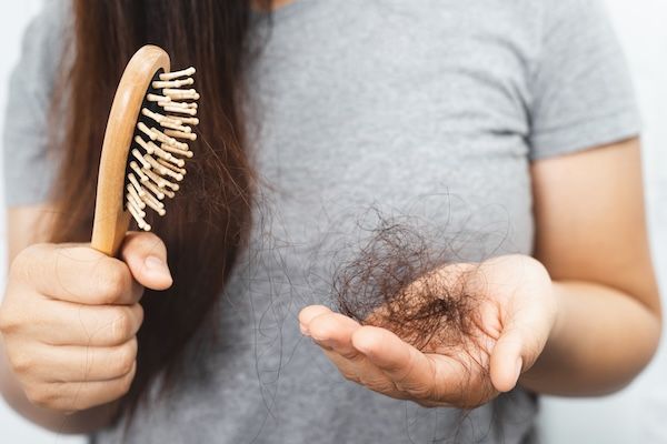 donna affetta da calvizie spazzola capelli in mano