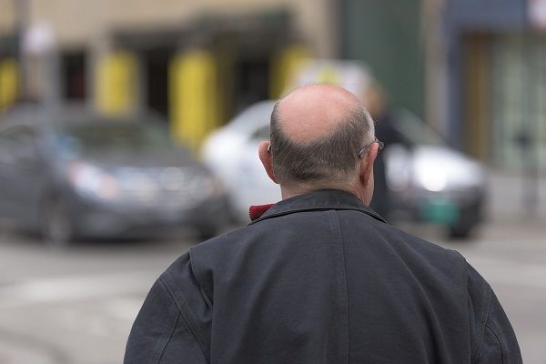 uomo anziano che cammina e che presenta segni di alopecia