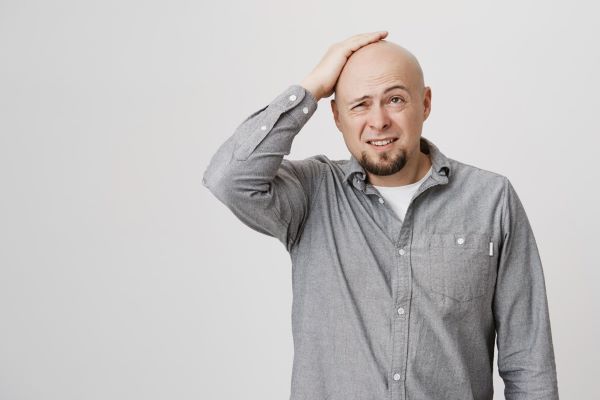Ragazzo calvo in camicia in posa con la faccia dubbiosa. La calvizie può essere temporanea o permanente.