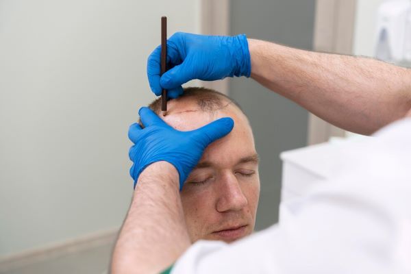 L'uomo calvo viene esaminato da un medico