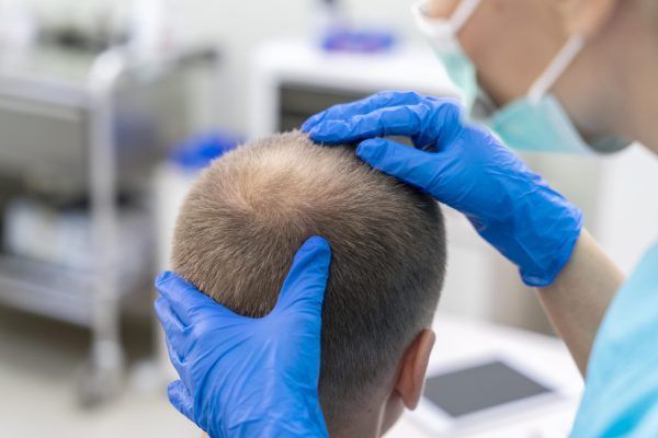 uomo con problemi di capelli essendo controllato dal professionista di capelli
