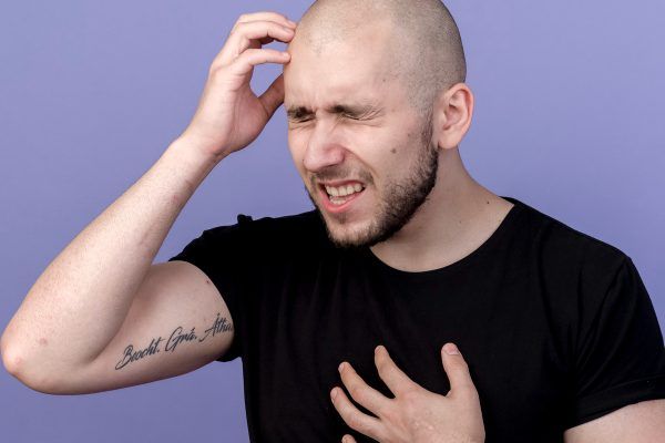 giovane uomo calvo con un'espressione infastidita - migliori trapianti di capelli in italia