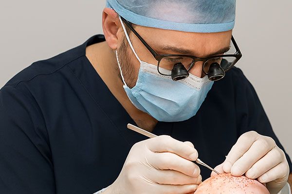 Chirurgo specializzato in trapianto capelli Turchia esegue tecnica FUE