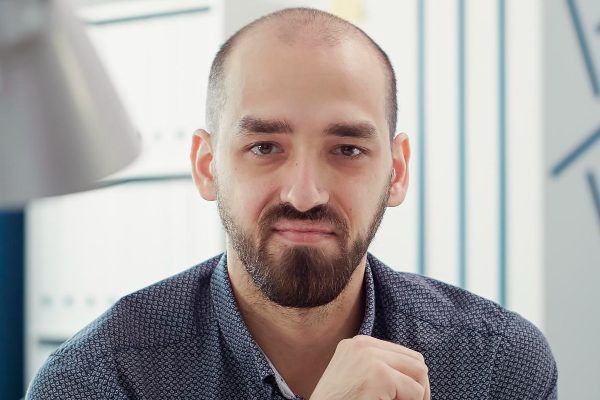 Calvizie dovuta a genetica ereditaria.