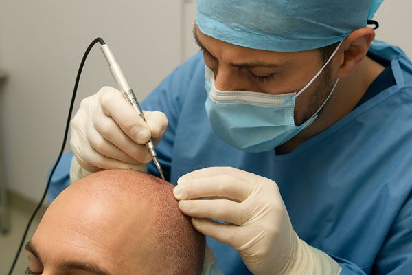 Medico a Torino durante trapianto capelli FUE con strumenti chirurgici