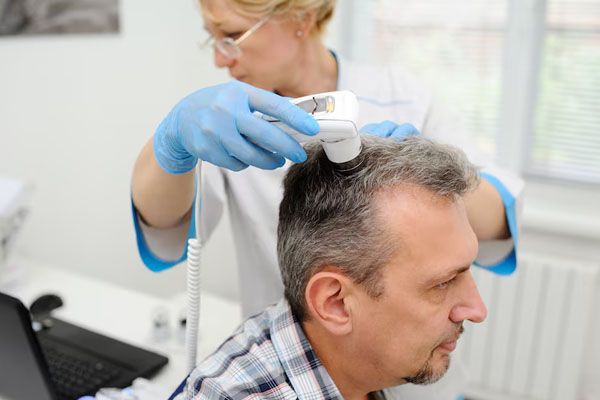 Uomo che cura i suoi problemi di calvizie - miglior paese per trapianto capelli