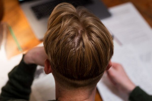 Testa maschile con taglio di capelli alla moda - miglior trapianto capelli Turchia