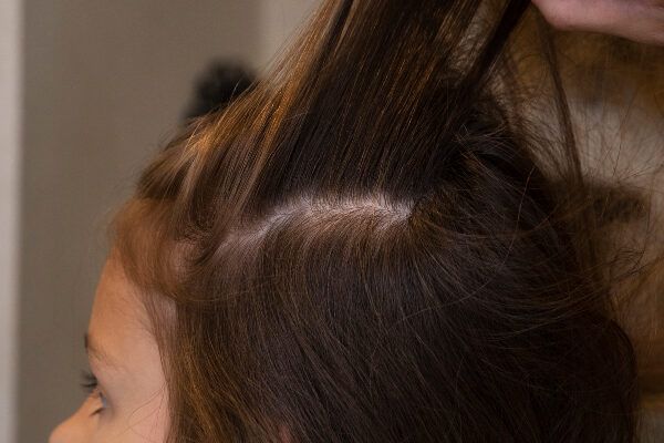 Il miglior trattamento per l'idratazione dei capelli.