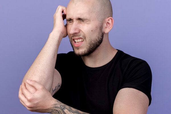 Calvo a meno di 30 anni?