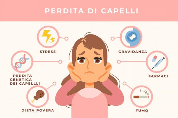 infografica sulla perdita dei capelli