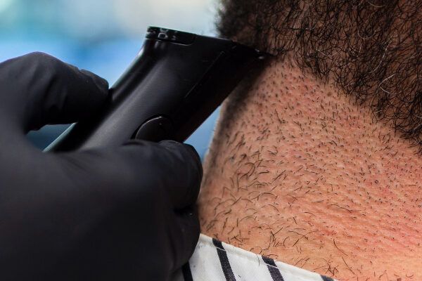 Aspetti da considerare sulla tricopigmentazione.