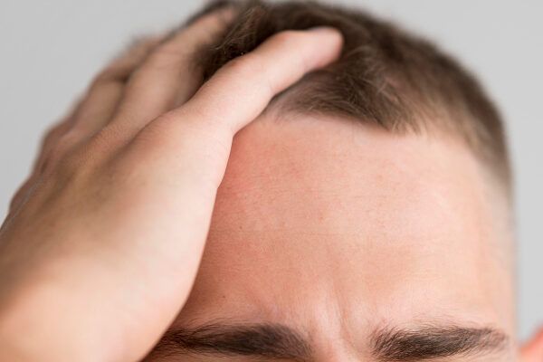 Cos'è la tricopigmentazione capillare?