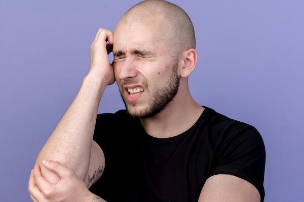 Alopecia nei giovani.