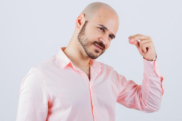 Alopecia nei giovani.