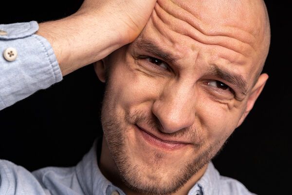 Giovane calvo con la barba fruttata che si strofina la testa pelosa - Calvicie influisce livello psicologico.