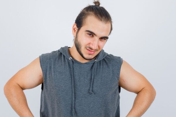 Giovane con stempiatura, capelli lunghi ed espressione di stanchezza fisica - Alopecia nei giovani.