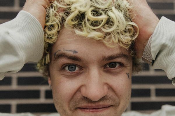 Giovane con i capelli ricci che si tocca la testa mentre sorride alla telecamera e mostra i suoi occhi con eterocromia.