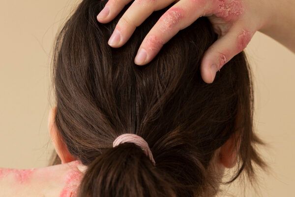 vista posteriore della testa di una donna