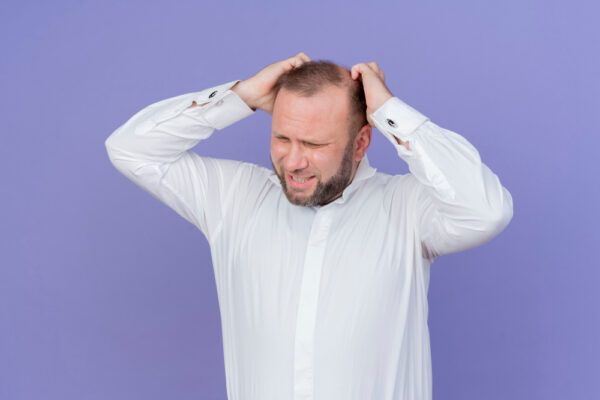 Uomo con alopecia areata in posa su sfondo viola mentre si tiene disperatamente la testa,