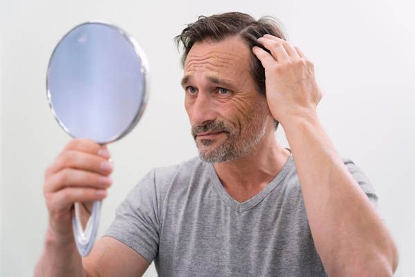 luomo si guarda allo specchio preoccupato - miglior trapianto capelli Italia