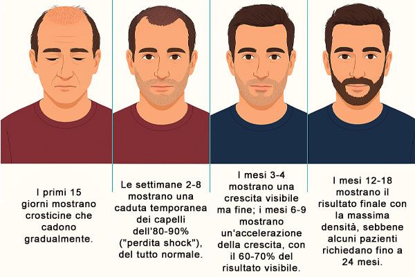evoluzione realistica del trapianto