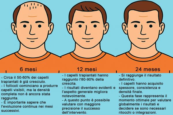 confronto dellevoluzione di un trapianto