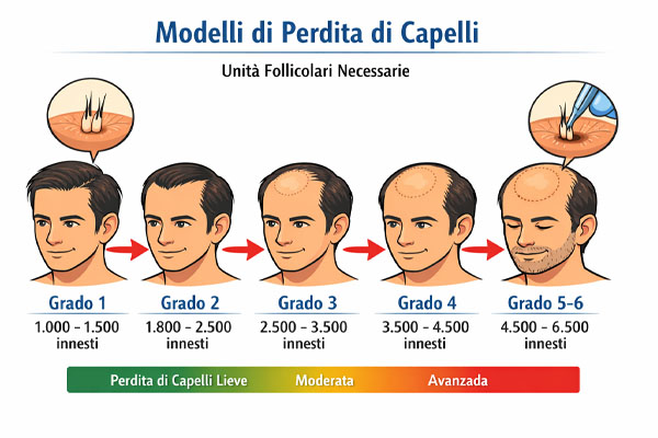 diagramma comparativo dei modelli di perdita dei capelli e delle unità follicolari necessarie