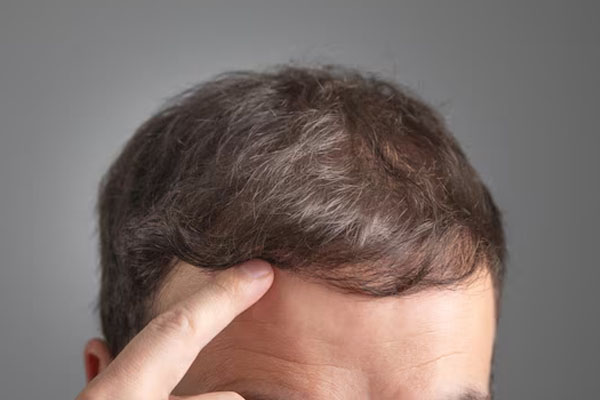 primo piano dei capelli di un uomo indicati dal suo stesso dito